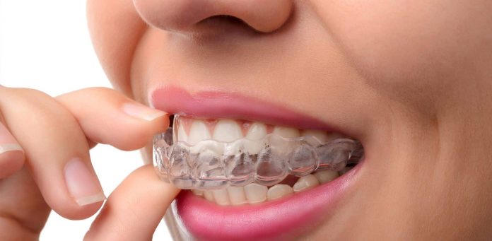How much does Invisalign cost?
